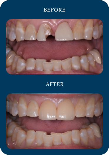 Before and after dental treatment example two